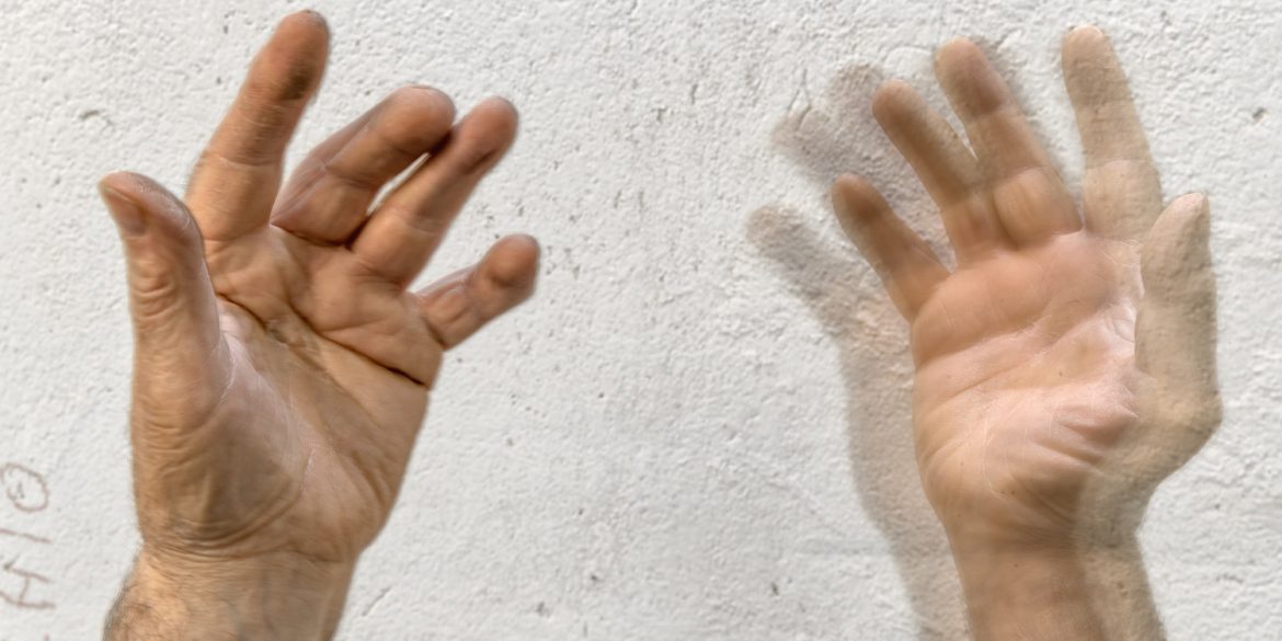 Mani di un malato di Parkinson. Foto di Giovanni Diffidenti